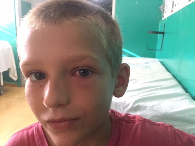 Paul’s Eye and the Power of Facebook — How News of an Allergic Reaction Reached Six Countries Before Mom and Dad
