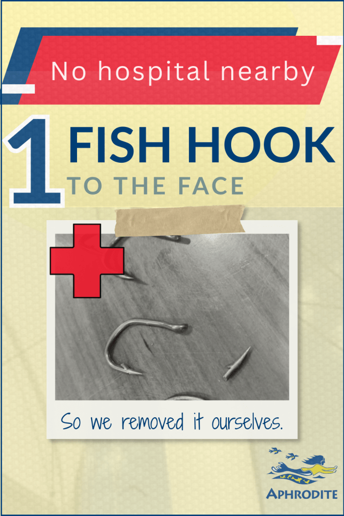 A picture of the actual fish hook that entered Paul's face, forcing us to perform emergency triage in the anchorage on our sailboat in Munda, Solomon Islands.