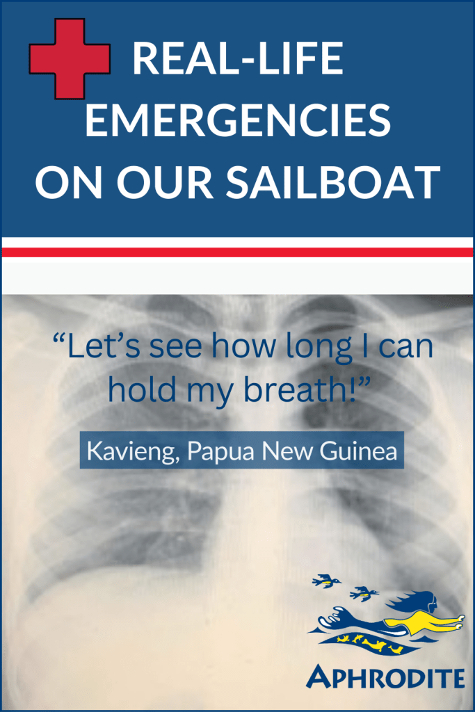 An x-ray of Paul's actual lung after he had aspirated water during his shallow water blackout.